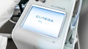 CuteraV machine up close