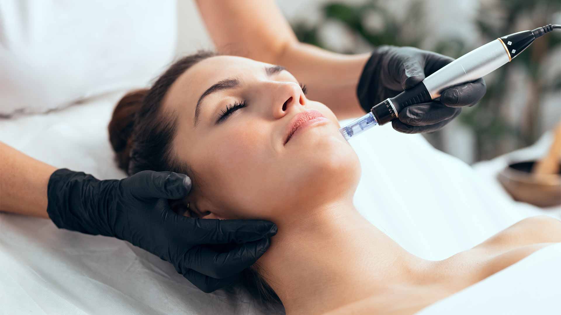 Microneedling